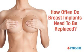 how often do breast implants need to be replaced blog