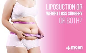 liposuction or weight loss surgery or both blog