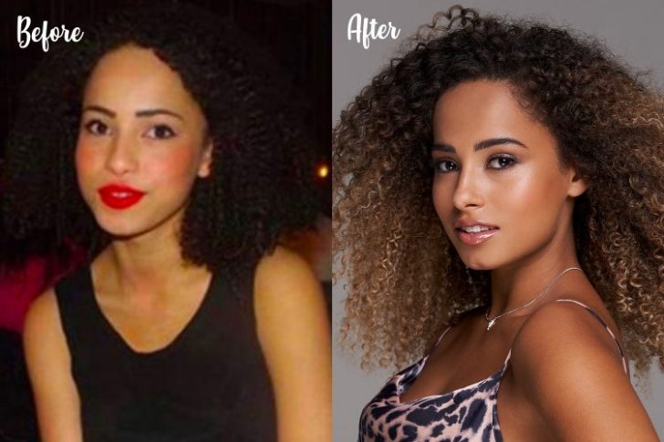 Plastic Surgery in Love Island: A Close Up To Islanders