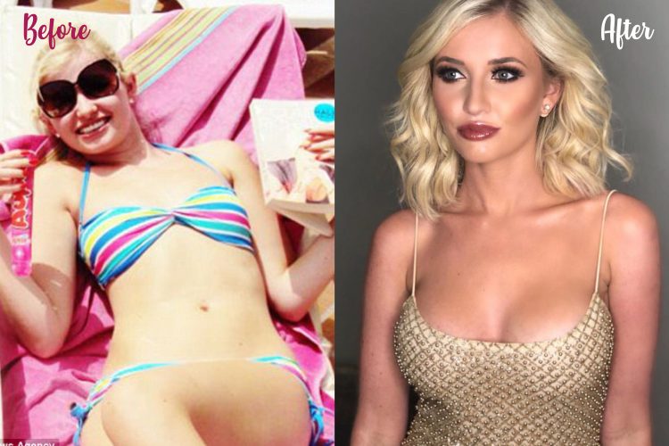Amy plastic surgery