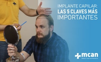 implante capilar las 5 claves mas importantes blog