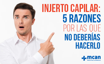 Injerto capilar: 5 razones por las que NO deberías hacerlo