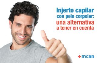 Injerto capilar con pelo corporal: una alternativa a tener en cuenta