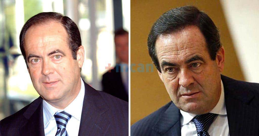 6 famosos con implante capilar 8 jose bono transplante capilar min jose bono transplante capilar min