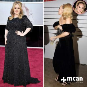 adele before after 01