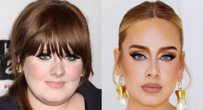 Adele vor und nach plastischer Chirurgie