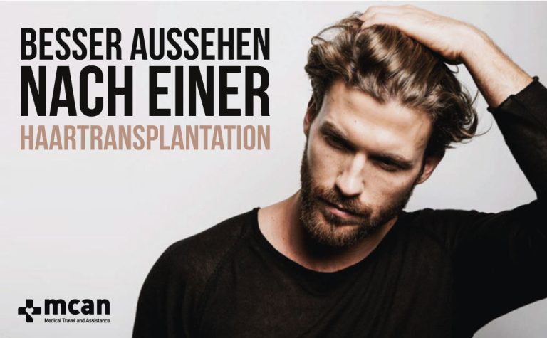 Besser aussehen nach einer Haartransplantation 20 Besser aussehen nach einer Haartransplantation Besser aussehen nach einer Haartransplantation 10:11