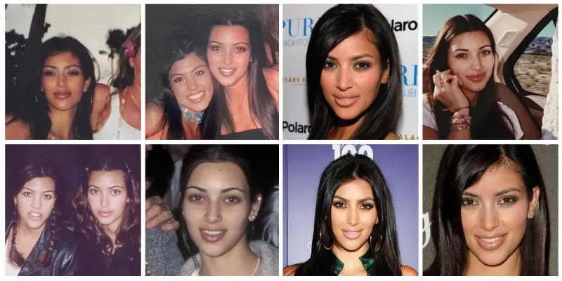 Kim Kardashian vor plastischer Chirurgie