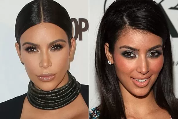Kim Kardashians Gesicht