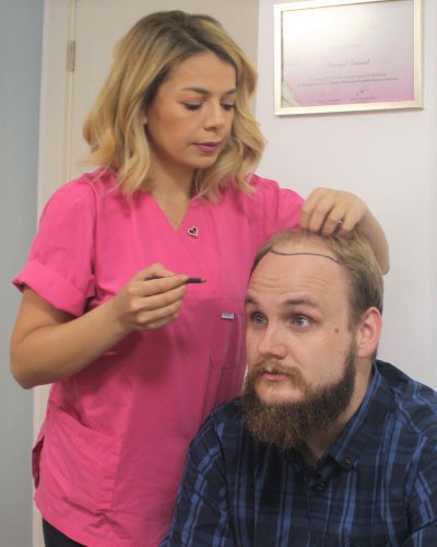 Best Hair Transplant Procedure