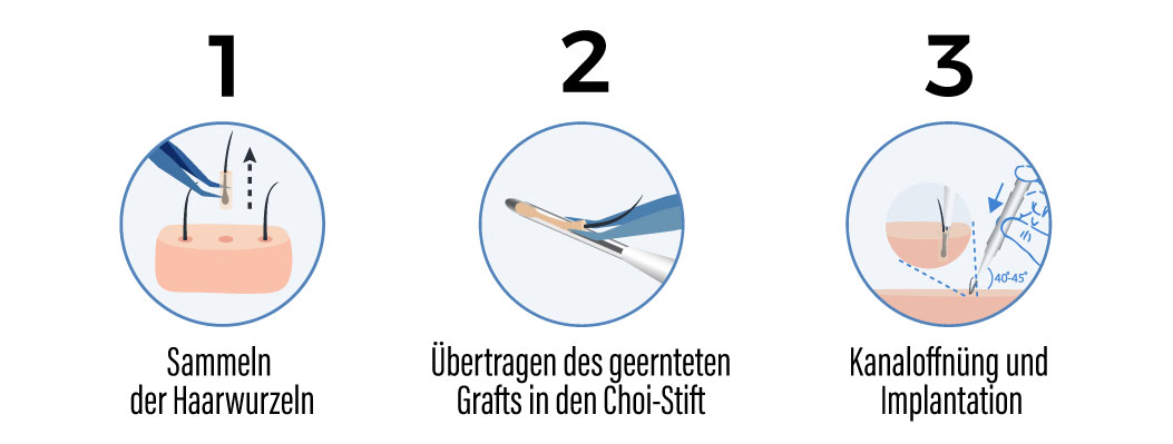 dhi schritten