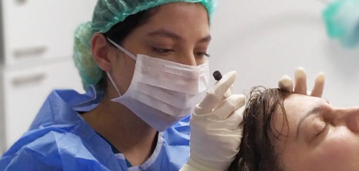 haartransplantation fur frauen 1