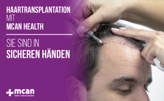 Haartransplantation mit MCAN Health – Sie sind in sicheren Händen