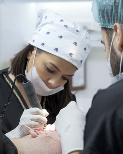 Hair Transplant Methods