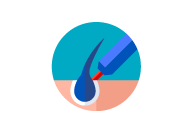 hair transplant