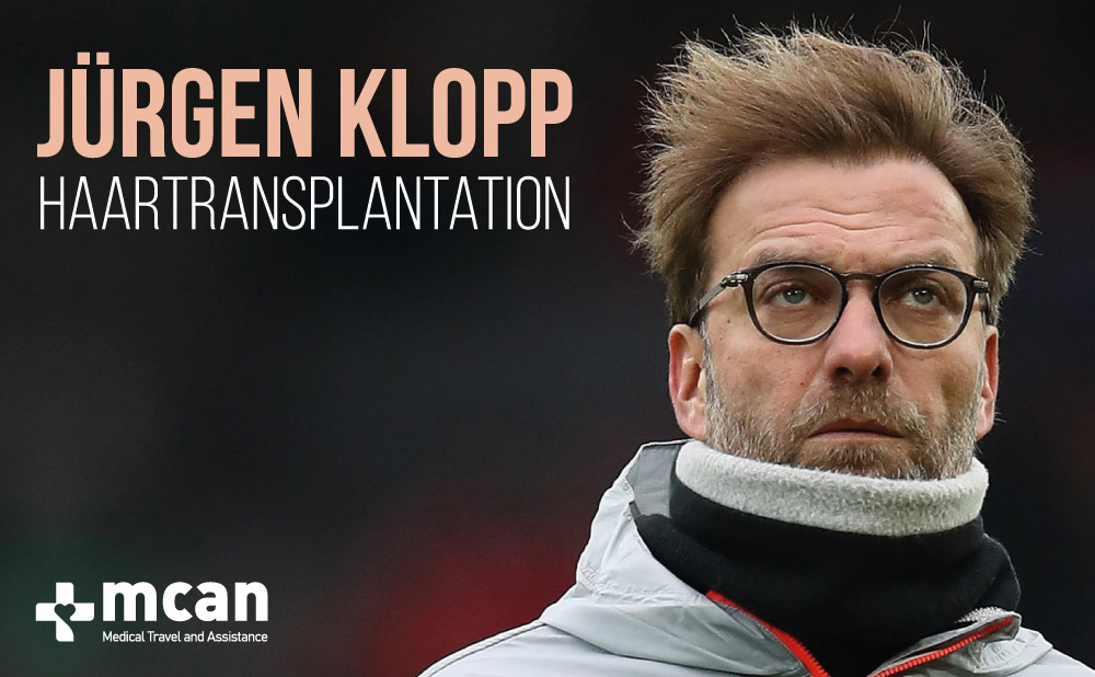 Jürgen Klopp Haartransplantation