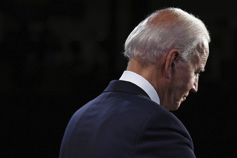 Joe Biden Crown looks bald after hair transplant 