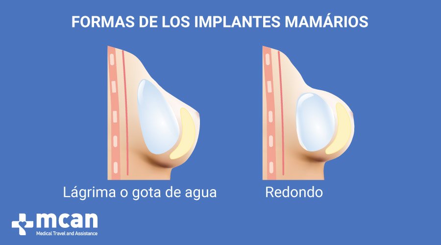 MCAN Health Aumento de pecho en Turquia Metodos de Aumento de Senos e Implantes mamarios