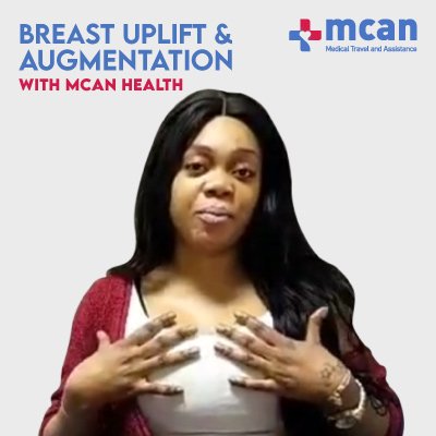 MCAN Health Breast Enlargement in Turkey Review video 3