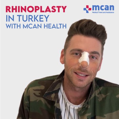 Nose Job Rhinoplasty in Turkey MCAN Health video review 1