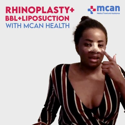 Nose Job Rhinoplasty in Turkey MCAN Health video review 2