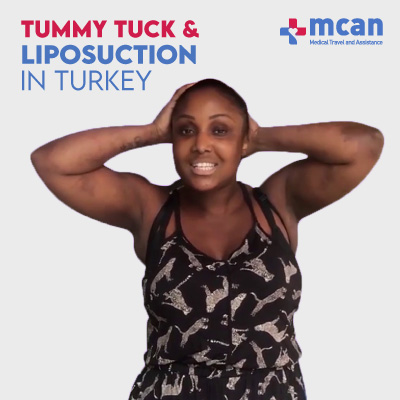 Tummy Tuck Turkey Reviews 01
