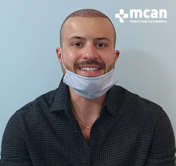 fue hair transplant turkey mcan health reviews