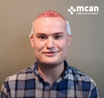 осстановление волос турция отзывы mcan health