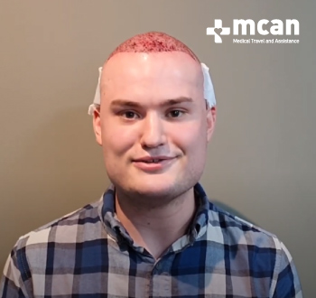 hair restoration turkey mcan health reviews