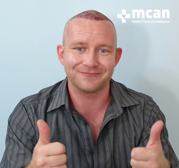 hair transplant turkey mcan health review