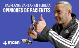 Trasplante capilar: opiniones de pacientes 3 juan1 1 juan1 1