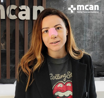 nosejob in turkey mcan health reviews