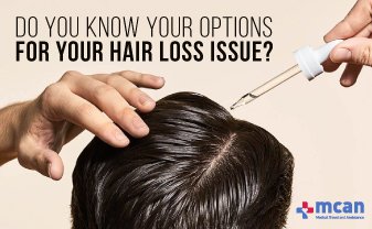 hair loss treatments mcan health