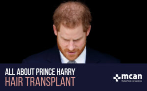 Prince Harry hair transplant
