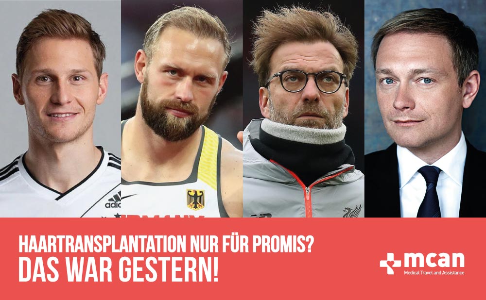 Haartransplantation nur für Promis