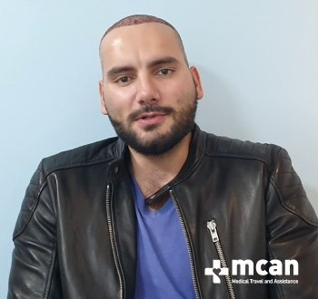 best hair transplant turkey mcan health reviews