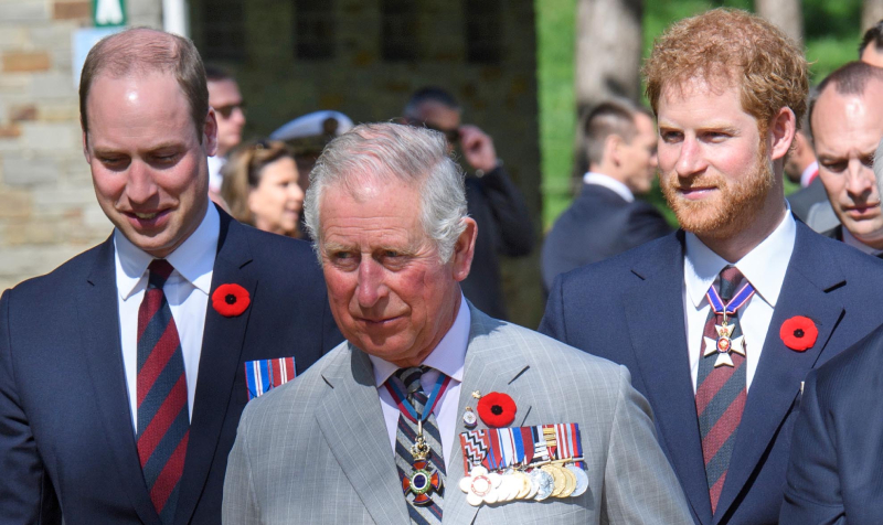 royal family and Prince Harry hair loss