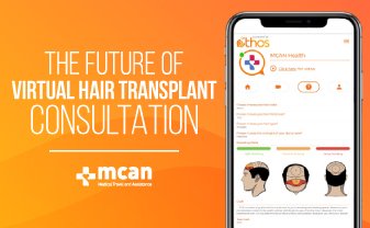 virtual hair transplant consultation