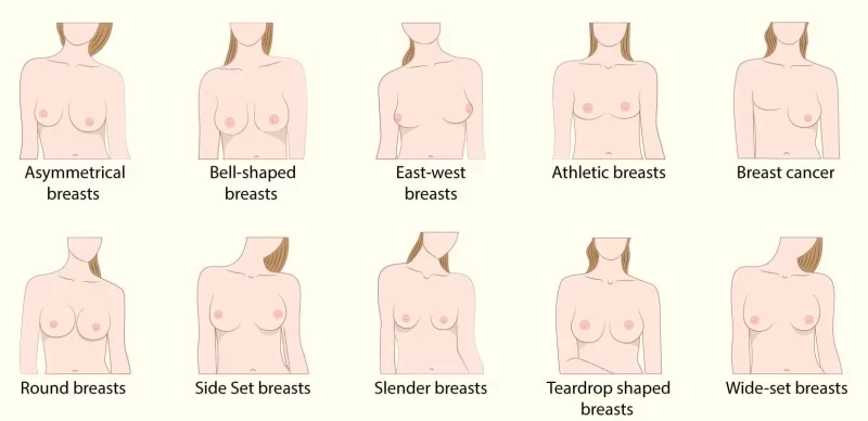 breast types 