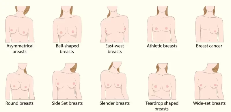 Ideal breast size is changing in time and by gender