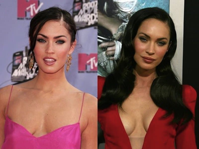 Megan Fox Brustimplantate vorher und nachher