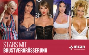 stars mit brustvergroberung for web