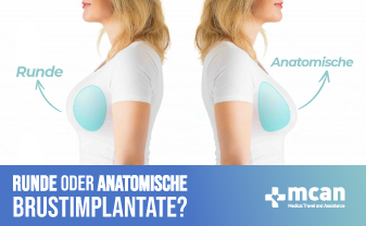 Runde oder anatomische Brustimplantate