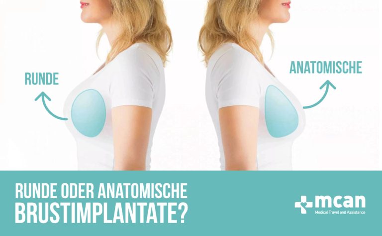 Runde oder anatomische Brustimplantate? 7 Runde oder anatomische Brustimplantate 2 Runde oder anatomische Brustimplantate
