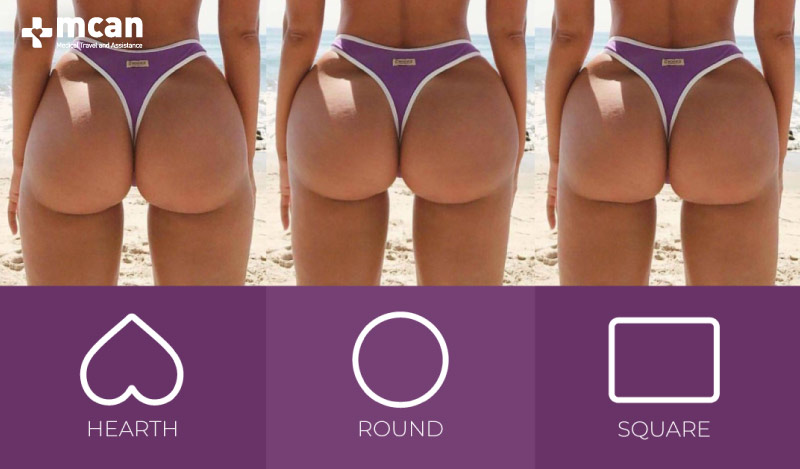 Buttocks Shape after BBL can be heart shape, round shape and square shape