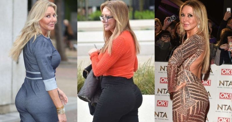 Carol Vorderman butt implantation