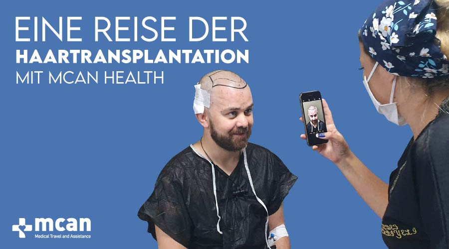 eine reise der haartransplantation mit mcan health