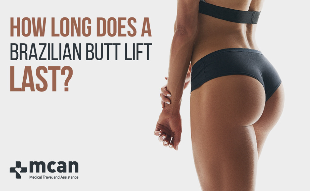 How Long Does a Brazilian Butt Lift Last? - Is It Permanent?