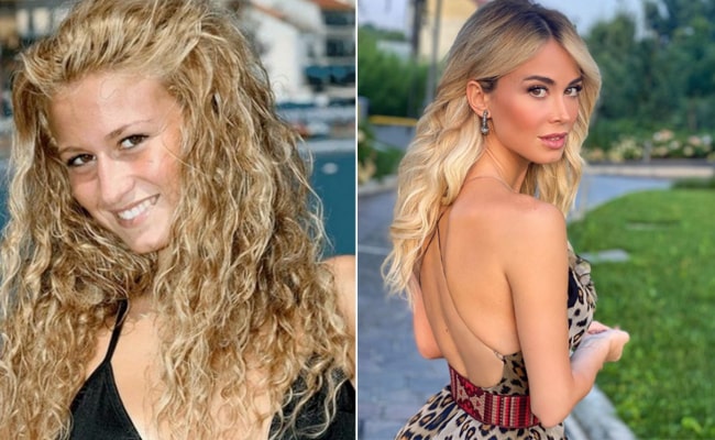 Las cirugías estéticas de Diletta Leotta: exnovia de Can Yaman 3 Diletta antes y despues 1 min Antes y después de Diletta Leotta | MCAN Health Blog