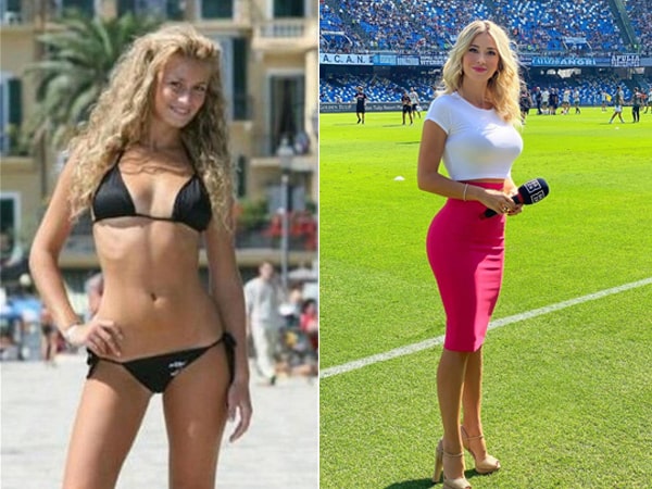 Las cirugías estéticas de Diletta Leotta: exnovia de Can Yaman 4 Diletta antes y despues 2 min Diletta Leotta antes y después | MCAN Health blog